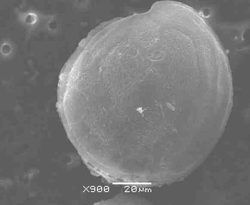 Murcia's Mediterranean coast under the microscope as toxic microalgae are detected